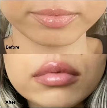 “Plump N Go” Instant Lip Filler Plumper (1ml)
